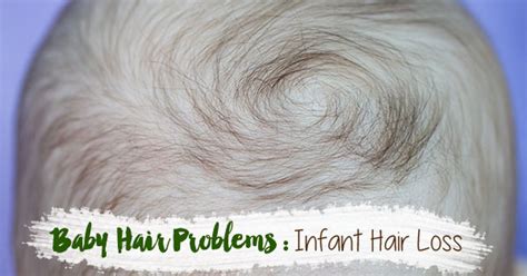 Baby Hair Problems: Infant Hair Loss - Moringa-O2