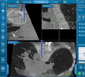 O-Arm® Surgical Imaging System | Hartford Hospital