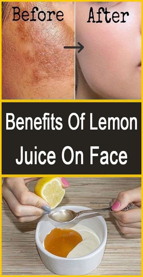 Lemon Juice Benefit On Skin - health benefits