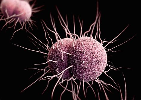 Gonorrhea: Symptoms & Treatment | Live Science