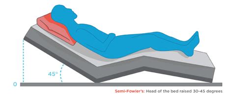 Positionnement du patient | La position de Fowler et ses variantes