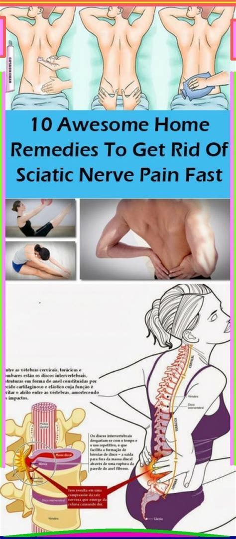 Pin on Back Pain Nerve