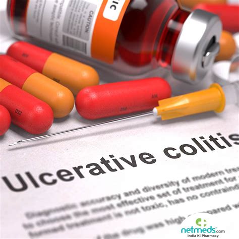 Ulcerative Colitis: Types, Symptoms And Treatment