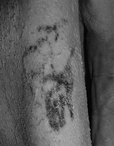 World's oldest tattoo found on Egyptian mummy in British Museum | Daily Star