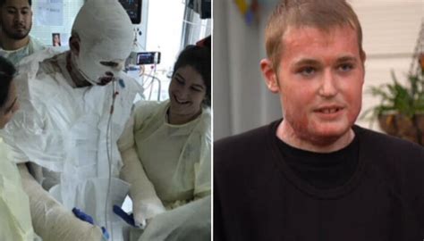 Teenage survivor of White Island eruption opens up about his road to recovery | Newshub
