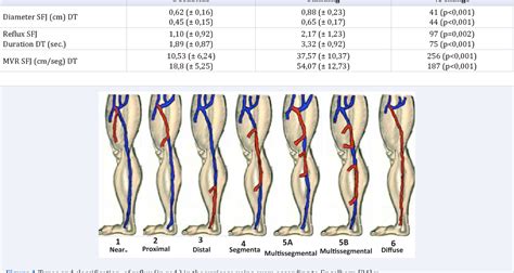 Figure 1 from Vascular Ultrasound Exam for Varicose Veins . Importance of Patient Positioning ...