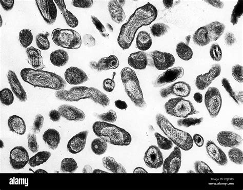 Coxiella burnetii bacteria Stock Photo - Alamy