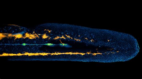 Lateral line cells and melanocytes migrating in a zebrafish embryo ...