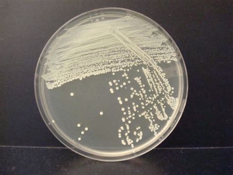 STREAK PLATE – Hands On Microbiology