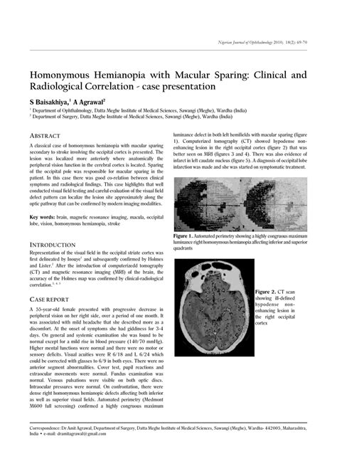 (PDF) Homonymous Hemianopia with Macular Sparing: Clinical and Radiological Correlation-case ...