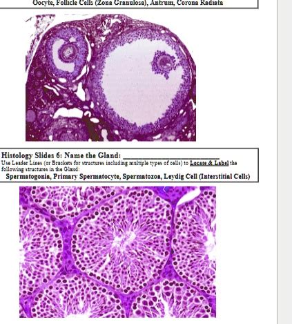 SOLVED: Where is Oocyte, Follicle Cells (Zona Granulosa), Antrum ...