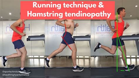 Hamstring tendinopathy & Running technique