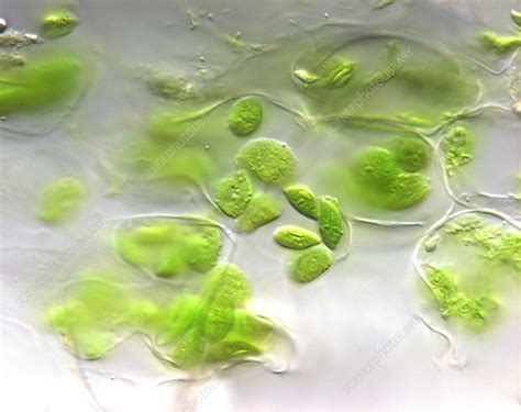 Chloroplasts, light micrograph - Stock Image - C011/9275 - Science Photo Library