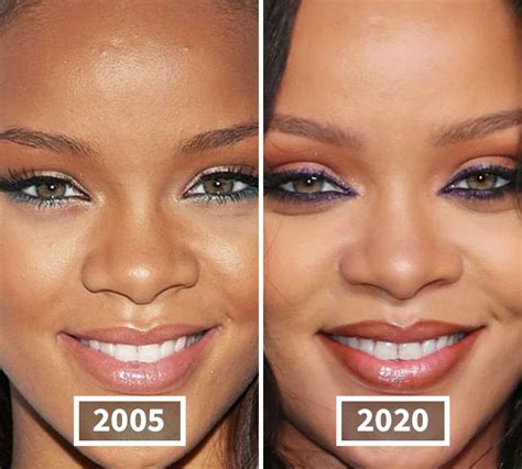 This Instagram Account Points Out How Much Celebrity Faces Have Changed ...