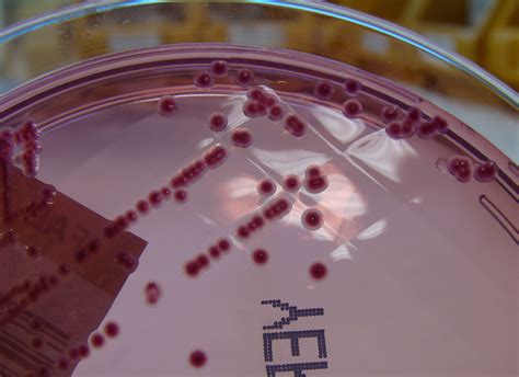 Yersinia enterocolitica growing on C.I.N. Agar - Detail 1 | Flickr