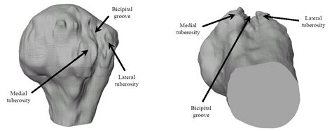 Doctors Gates: Bicipital Groove