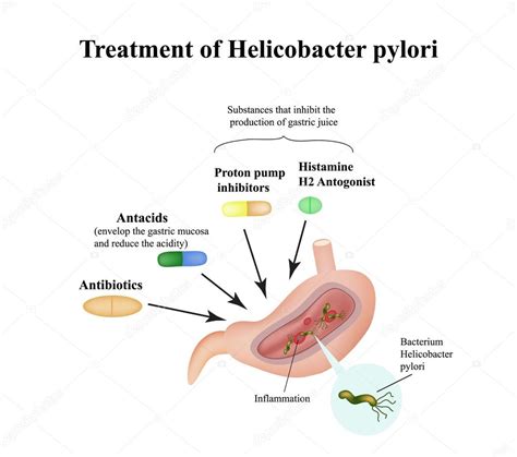 Treatment of Helicobacter pylori. Medications. Antacids, proton pump blockers and H2-histamine ...