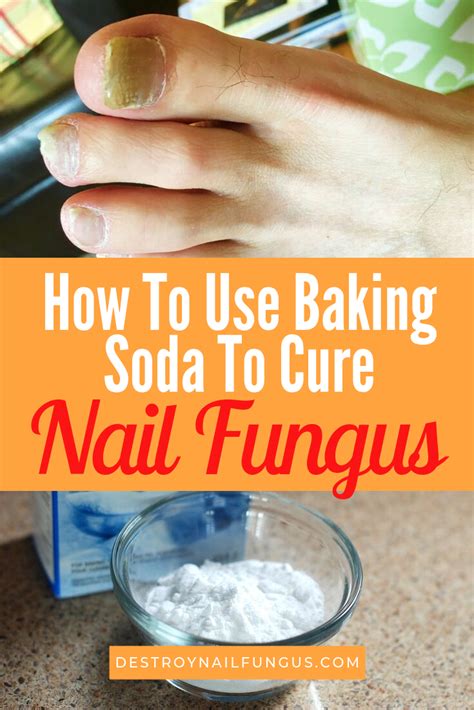 How You Can Use Baking Soda To Fight Toenail Fungus (Now!)