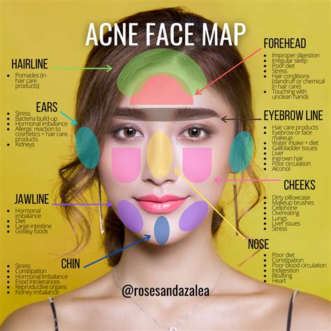 Face mapping your acne – Artofit