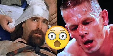 Most Disturbing Pictures of WWE Wrestling Injuries