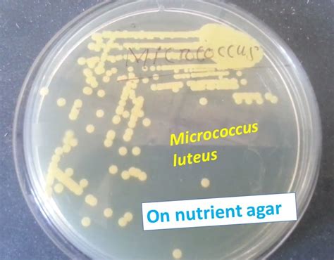 Nutrient Agar Recipe | Deporecipe.co