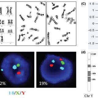 A flowchart showing the performance from NIPS to cytogenetic analysis... | Download Scientific ...