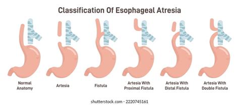 26 Pediatric gastrointestinal tract 이미지, 스톡 사진 및 벡터 | Shutterstock