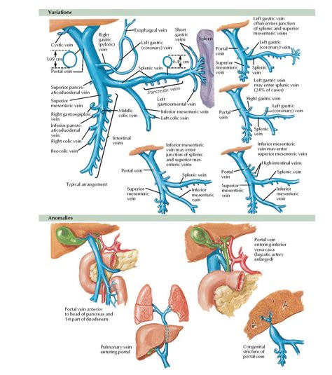 Variations and Anomalies of Hepatic Portal Vein Anatomy - pediagenosis