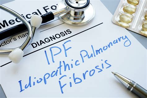 Idiopathic Pulmonary Fibrosis Diagnosis - Rare Disease Advisor