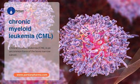 Chronic Myeloid Leukemia (CML) - parsianpharma