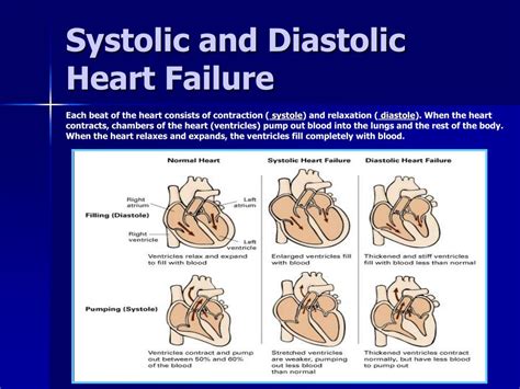 Ppt Diastolic Heart Failure Powerpoint Presentation Free To | Hot Sex Picture