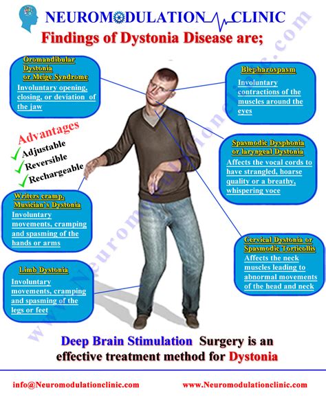 Neuromodulation Center | Deep Brain Stimulation | Baclofen