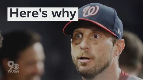 Max Scherzer's eyes are two colors. Here's why | 13newsnow.com