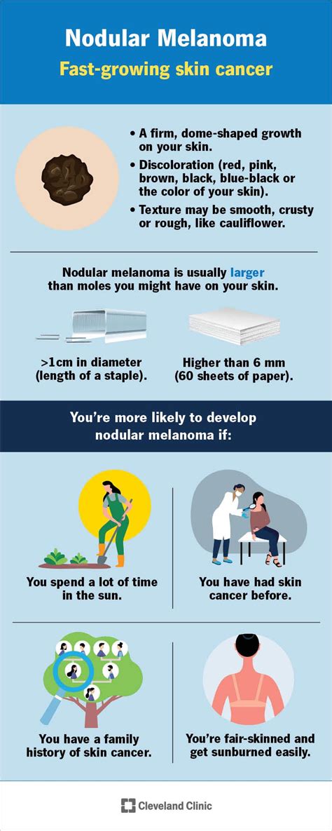 Understanding Melanoma: Causes, Symptoms, And Treatments - Ask The Nurse Expert