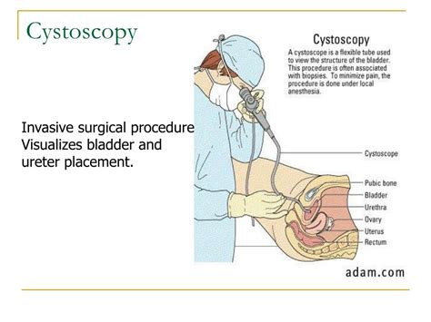 PPT - Genitourinary Disorders PowerPoint Presentation, free download ...