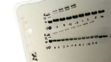 How To Choose the Right Western Blot Detection Method | Technology Networks