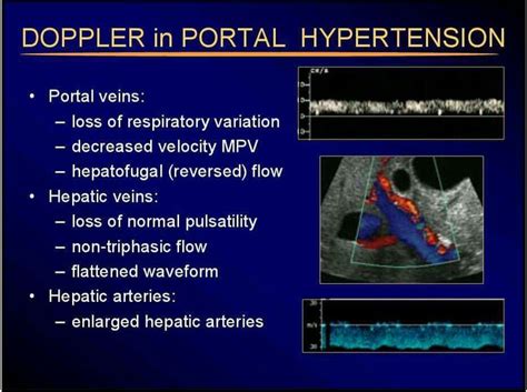 Pin by PeiEn Keong on ultrasound. | Interventional radiology, Cardiac ...