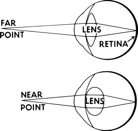 Ocular Accommodation - Refraction - Neurology - Teachmephysiology