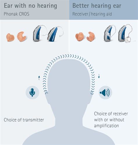 Phonak CROS and BiCROS | Tampa Bay Hearing and Balance Center