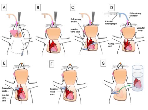 A Heterotopic Rat Heart Transplantation Model using Circulatory Death Donor Hearts (Scientific ...