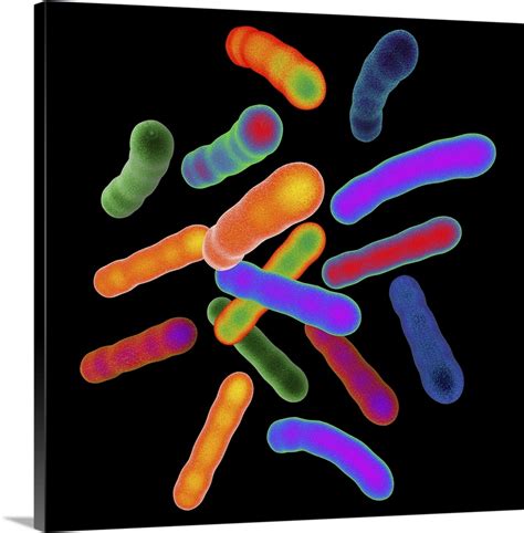 Tuberculosis bacteria, artwork Wall Art, Canvas Prints, Framed Prints ...