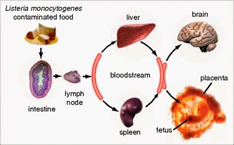 What is Listeria ? Why Sabra Recall Hummus? ~ Hi-Tech Talk