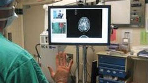 Hand gesture recognition system targets medical applications | Vision ...