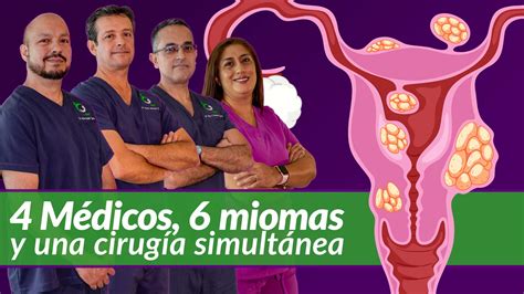 4 Médicos, 6 miomas y una cirugía vía abdominal y vaginal