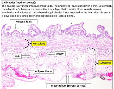 Gallbladder – Normal Histology – NUS Pathweb :: NUS Pathweb