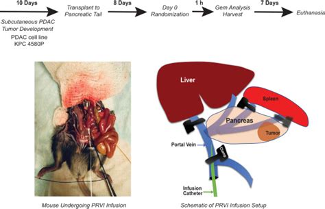 Pressure-enabled delivery of gemcitabine in an orthotopic pancreatic cancer mouse model - Surgery