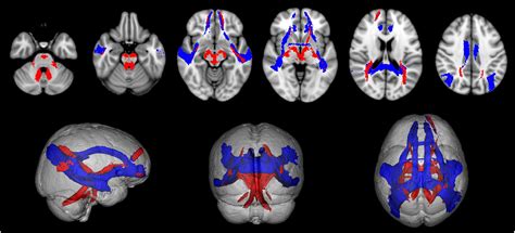Frontiers | Default Mode Network Structural Integrity and Cerebellar Connectivity Predict ...