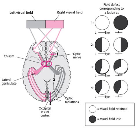 The Optic Pathway - Eye Disorders - Merck Manuals Professional Edition