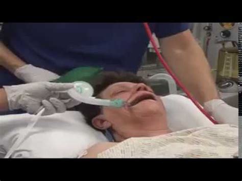 Intubation procedure - YouTube