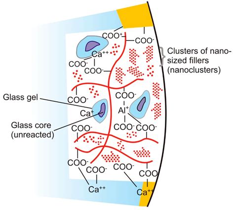 Glass Ionomer Cement Wikipedia | atelier-yuwa.ciao.jp